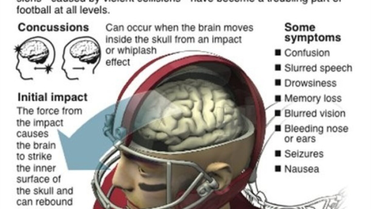 NFL examines sensors in helmets to measure impact of hits - NBC Sports