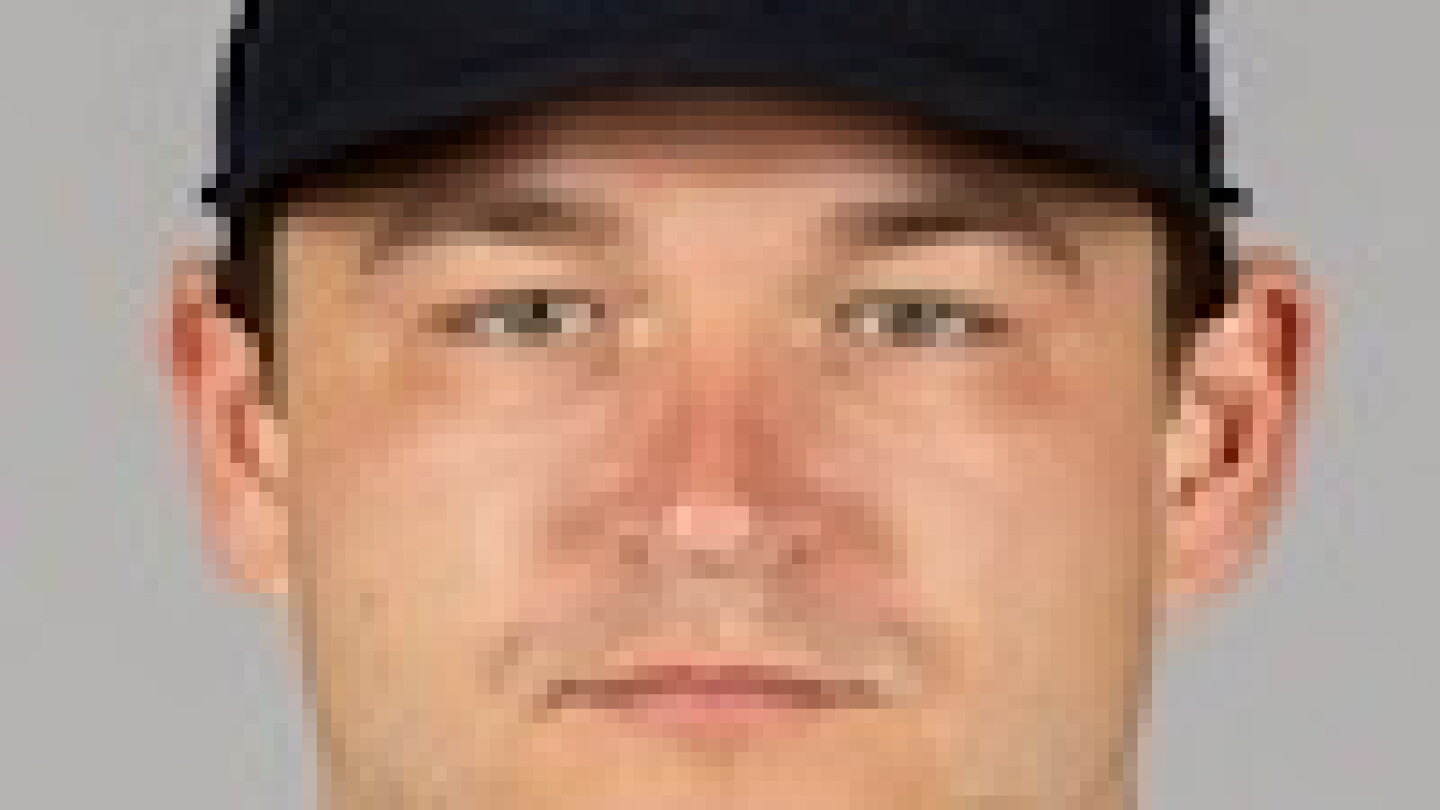 Dillon Dingler made an early exit from Wednesday’s game against the Athletics with an apparent right hand injury.