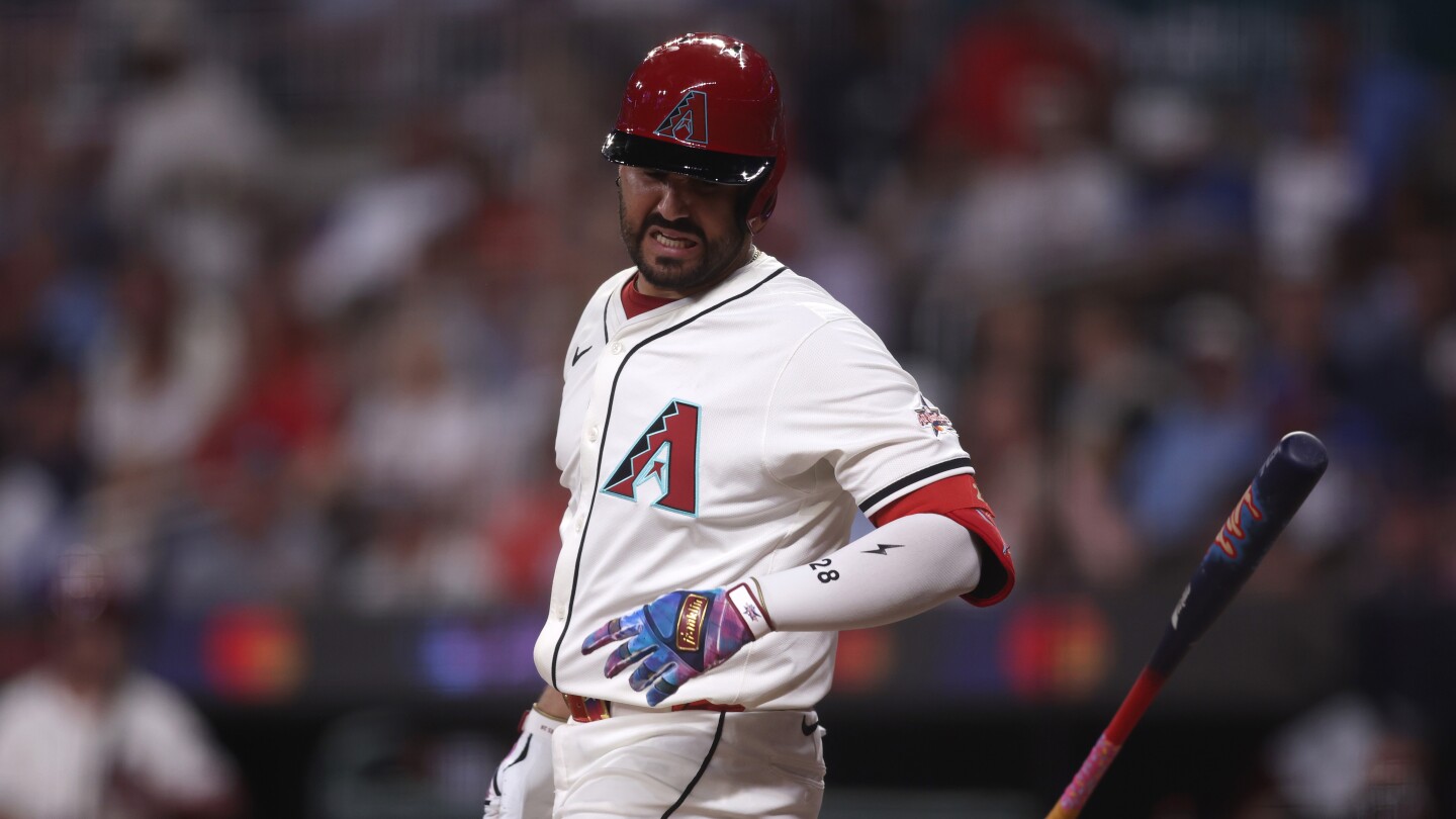 X-rays are negative after Diamondbacks’ Eugenio Suárez is hit by a pitch on left hand at All-Star Game X-rays are negative after Diamondbacks’ Eugenio Suárez is hit by a pitch on left hand at All-Star Game